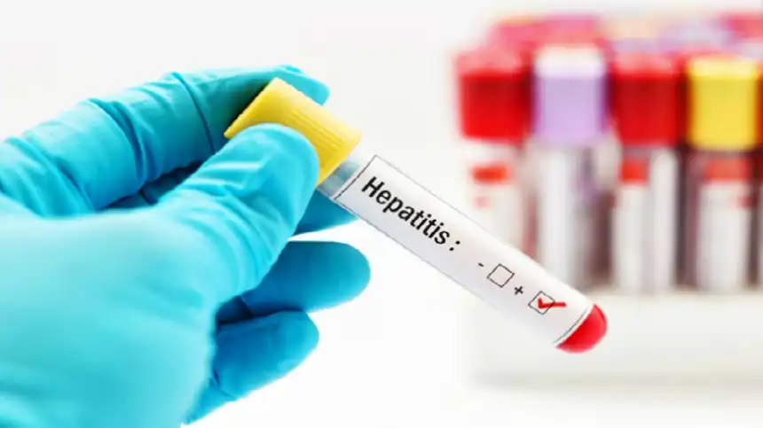 Noticias de Regionales. Una de cada dos personas con hepatitis crónica no sabe que tiene la enfermedad