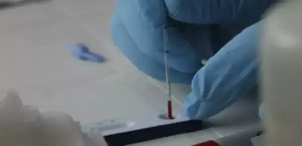 Regionales. La Provincia activa la Semana de Respuesta frente al VIH