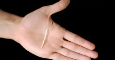 General Alvarado. Implantes subdérmicos y consejería en salud sexual en Miramar